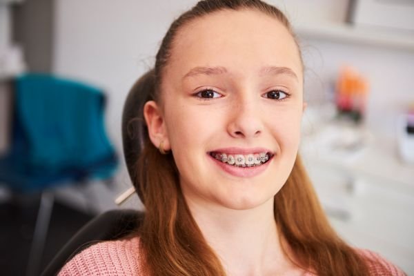 Braces