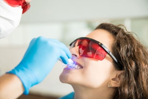 Teeth Whitening Results