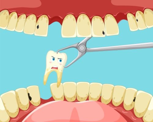 Extractions