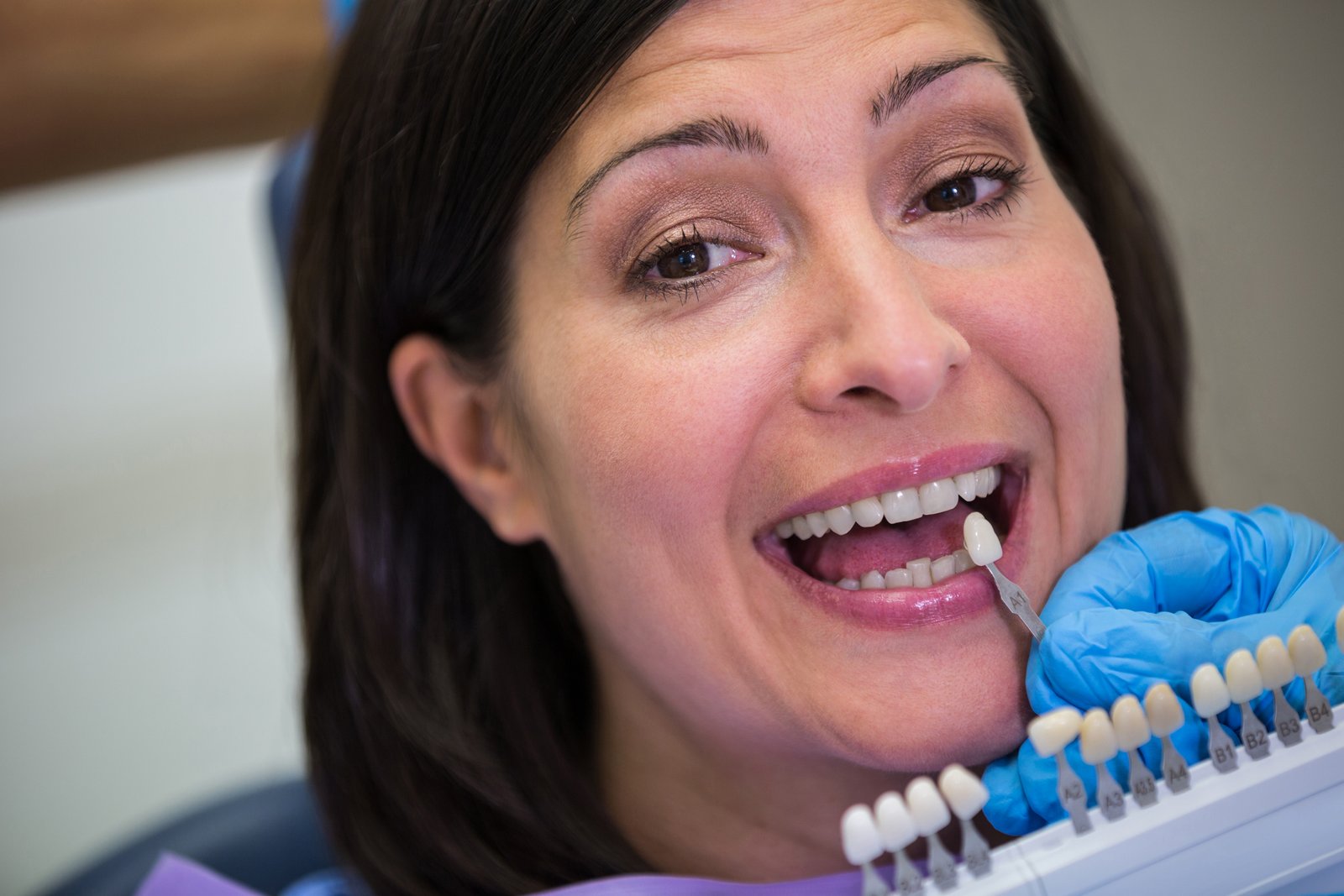 Implant Placement
